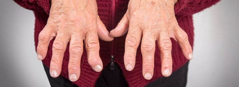 mains-senior-femme-arthrose-douleurs